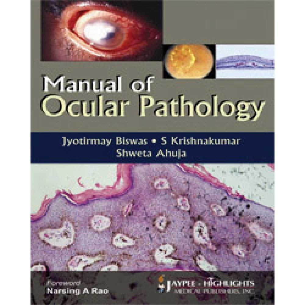 Manual Of Ocular Pathology