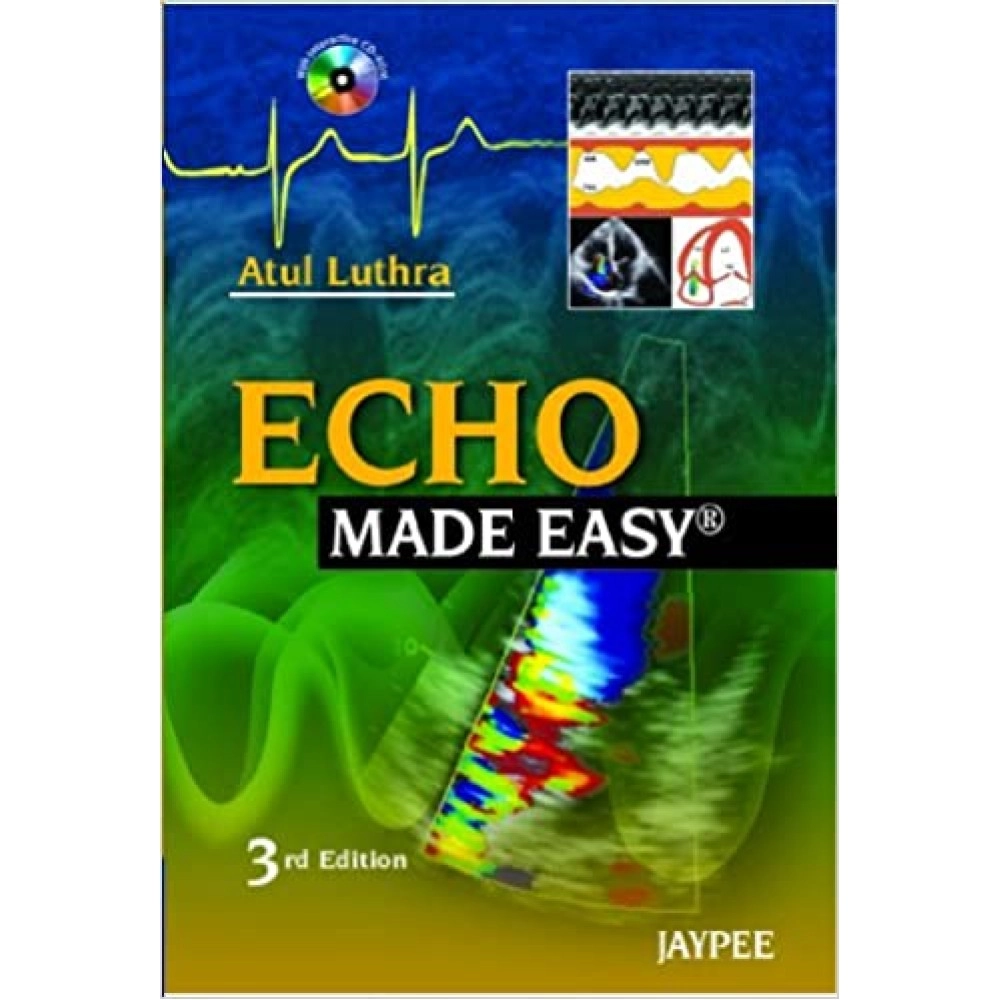 Echo Made Easy - 3rd Edition
