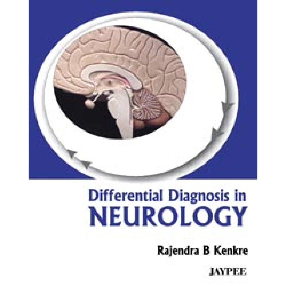 Differential Diagnosis In Neurology