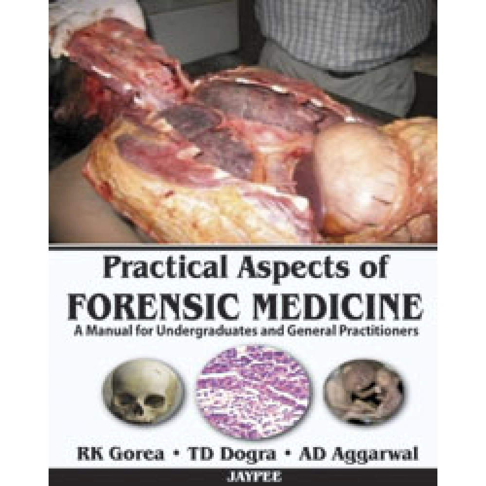 Practical Aspects Of Forensic Medicine 