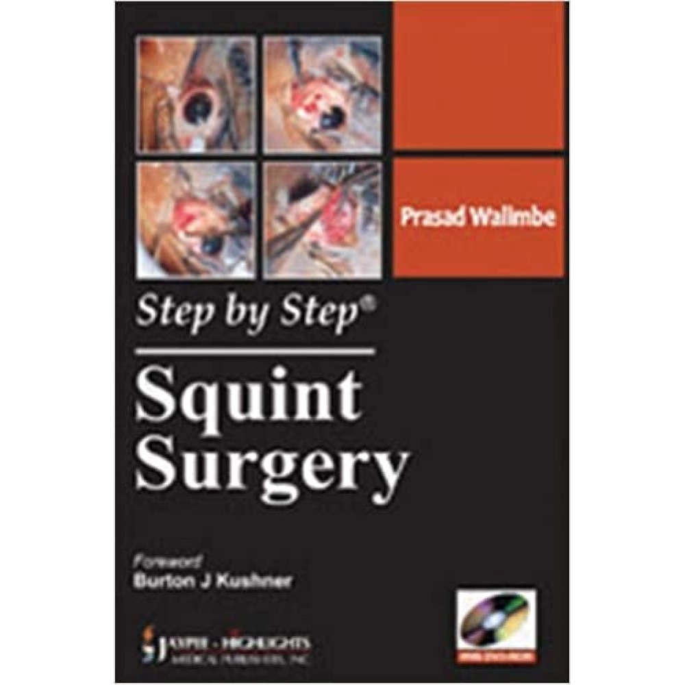 Step By Step: Squint Surgery 