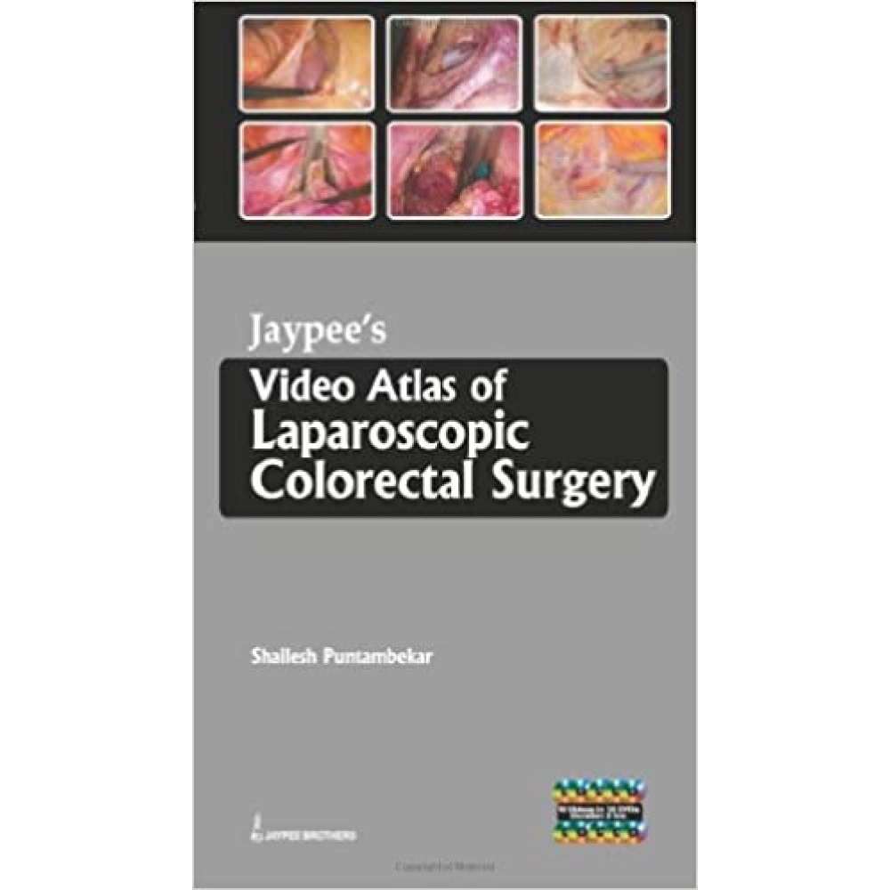 Jaypee's Video Atlas of Laparoscopic Colorectal Surgery