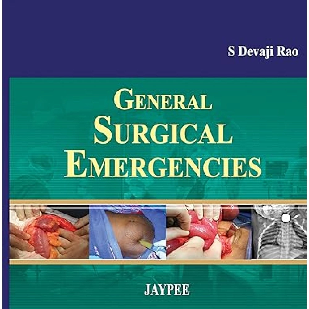 General Surgical Emergencies