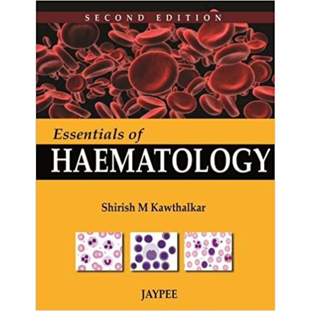 Essentials Of Hematology
