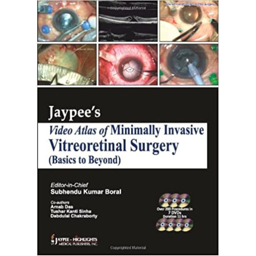 Jaypee's Video Atlas of Minimally Invasive Vitreoretinal Surgery (Basics to Beyond)