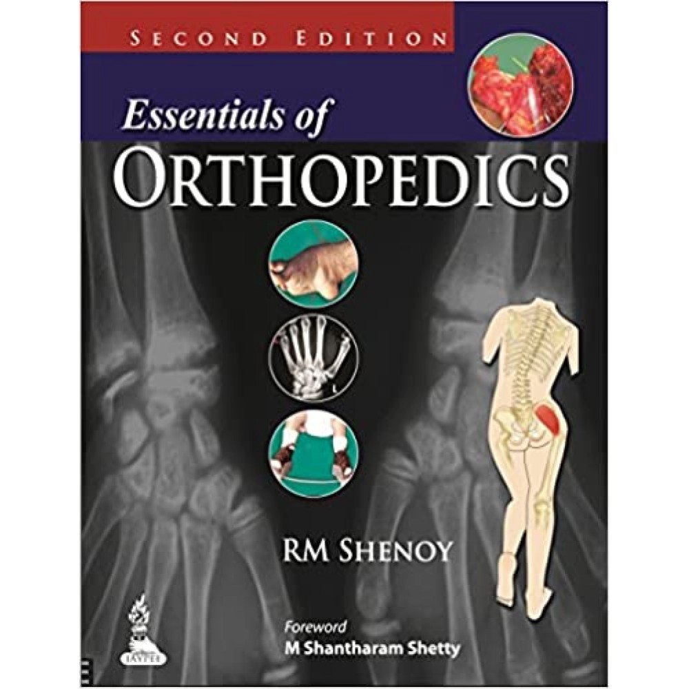 Essentials Of Orthopedics