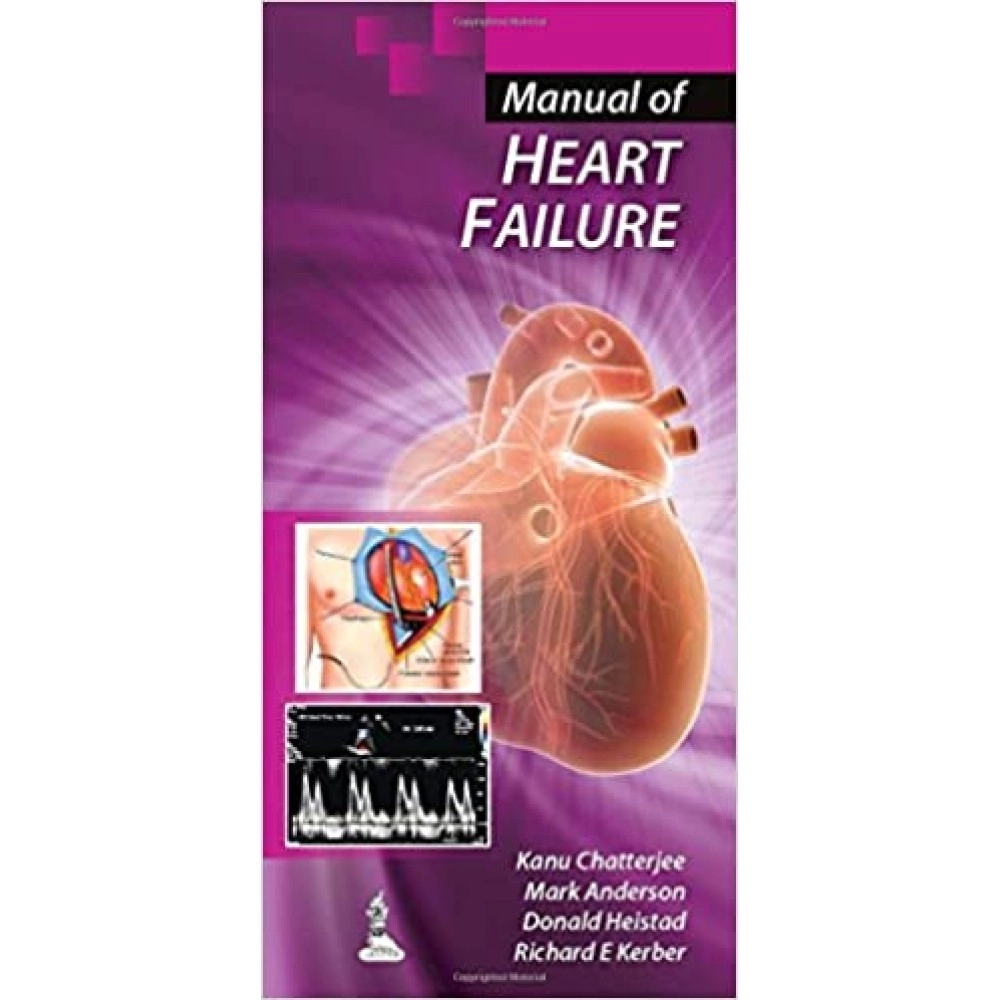 Manual Of Heart Failure
