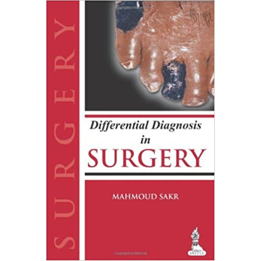 Differential Diagnosis In Surgery