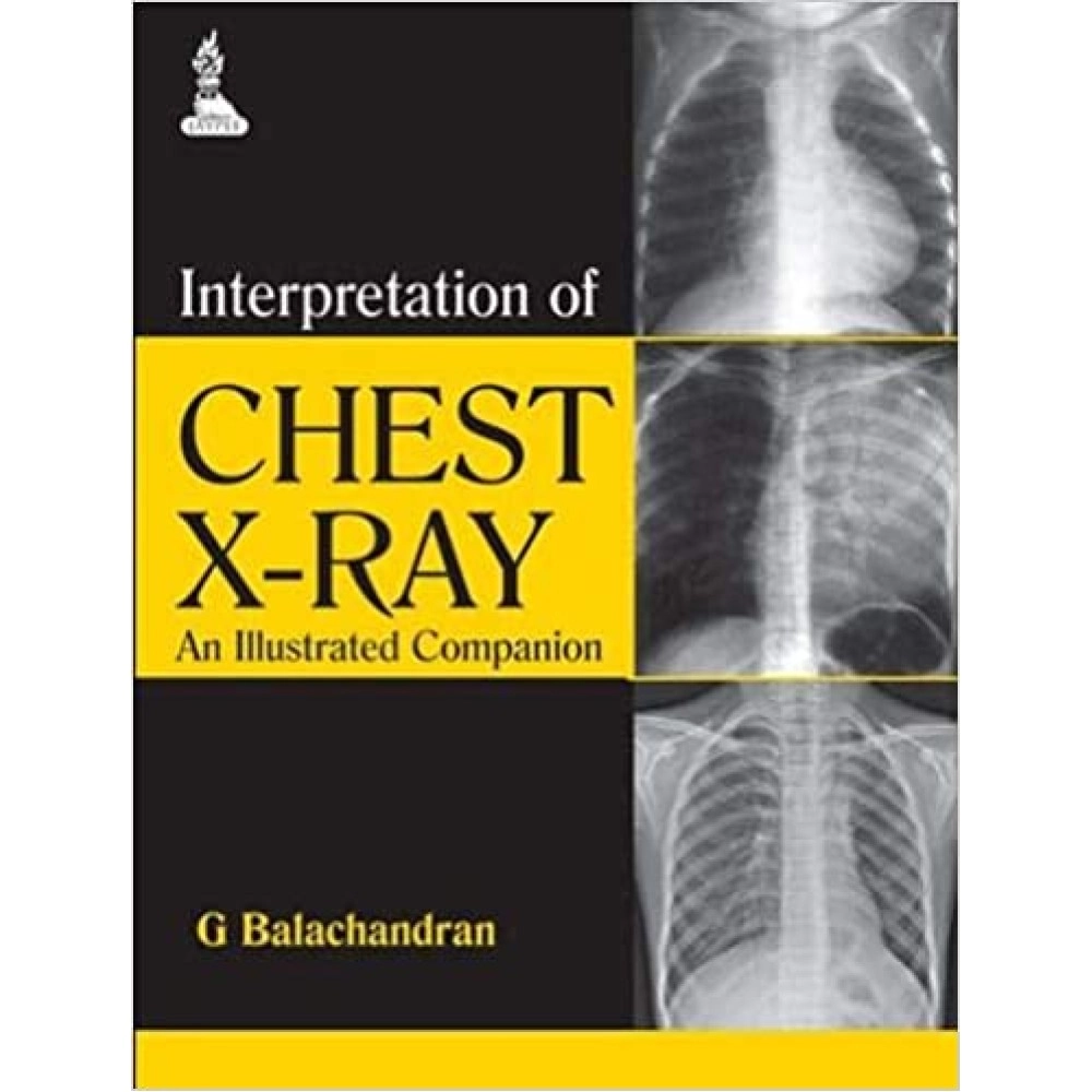 Interpretation of Chest X-ray: An Illustrated Companion