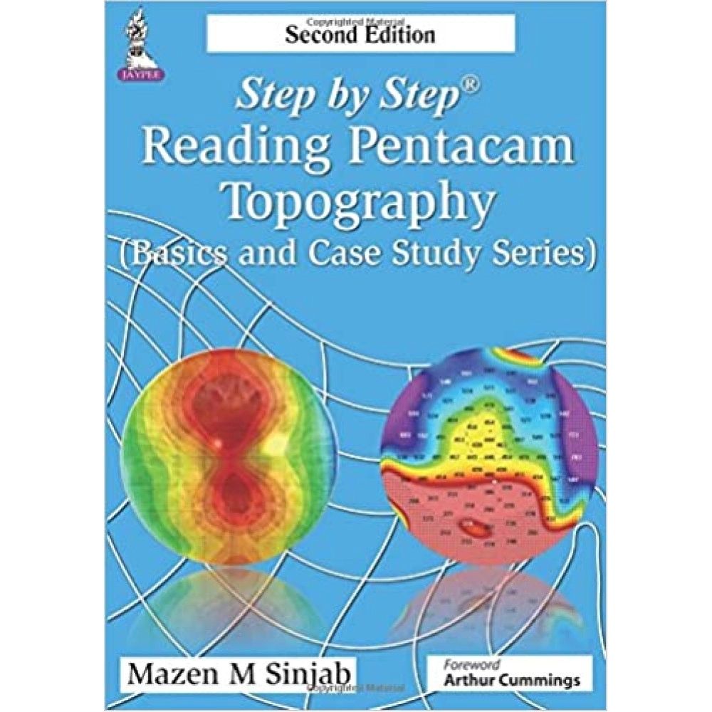 Step by Step Reading Pentacam Topography (Basics and Case Study Series)