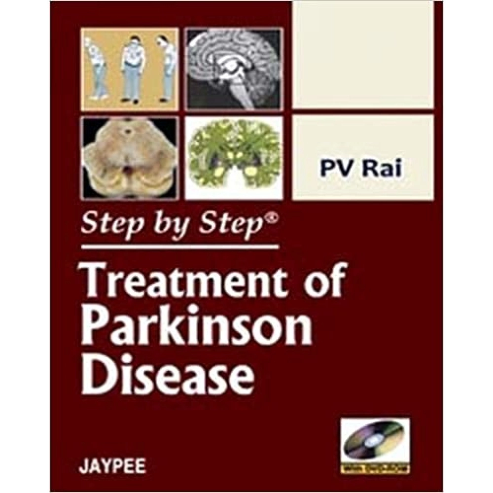 Step By Step Treatment Of Parkinson Disease