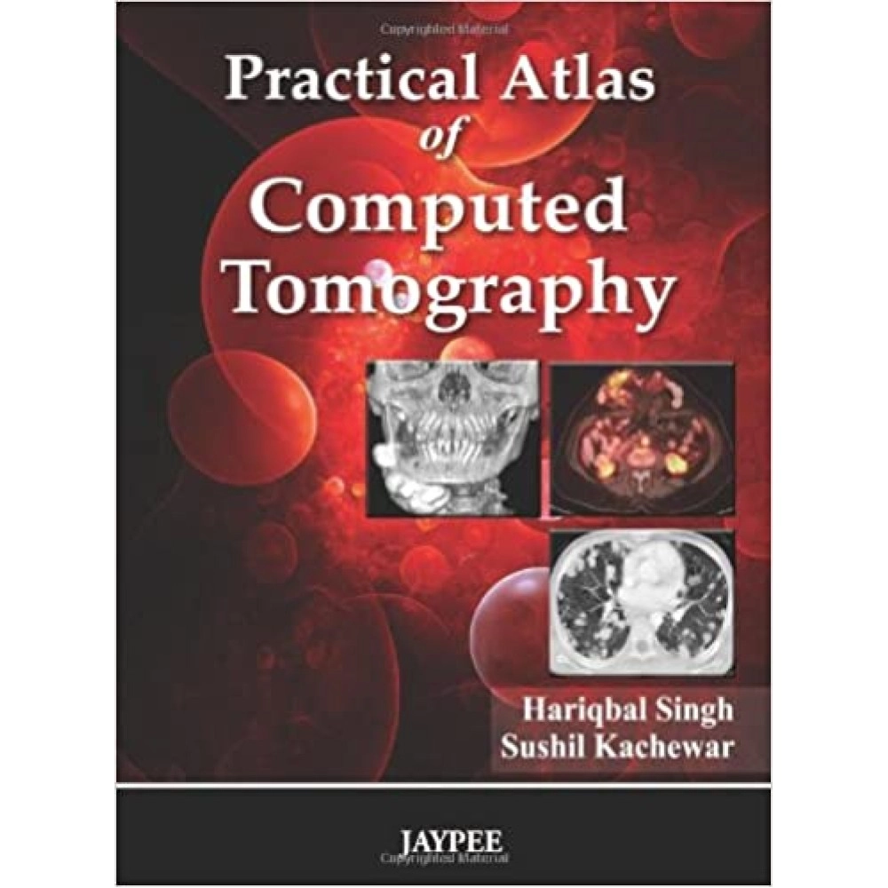 Practical Atlas of Computed Tomography