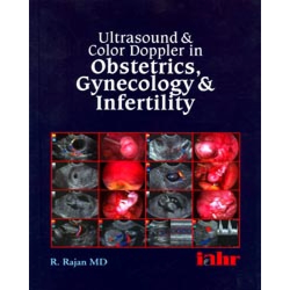 Ultrasound and Color Doppler in Obstetrics, Gynaecology and infertility